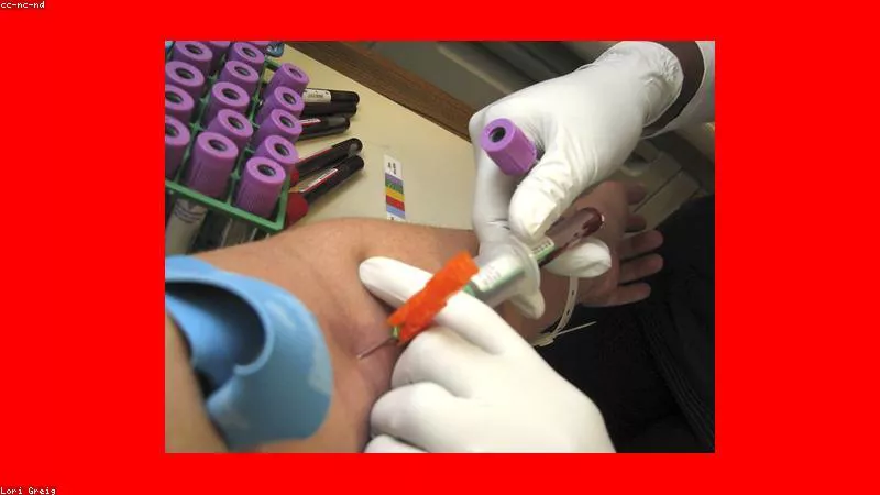 Corticoid trong xử trí cơn hen phế quản nặng cấp cứu