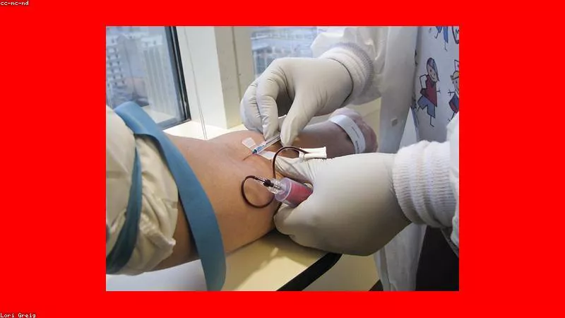 Sự nguy hiểm của việc tự ý mua Corticoid điều trị viêm da