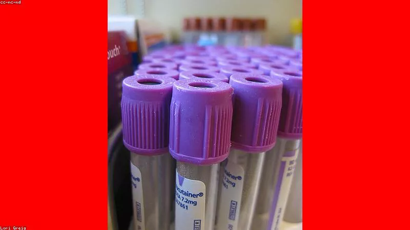 Phân tích y khoa hình ảnh Vai trò của corticoid trong điều trị dị ứng và viêm da